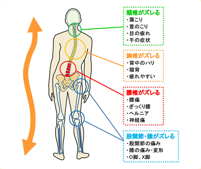 骨盤が歪むと